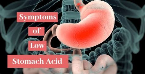 Low Stomach Acid Symptoms And Signs To Watch Out For Root Nutrition