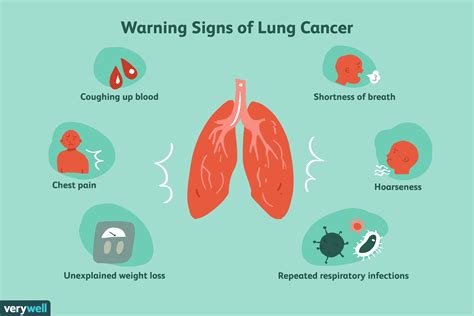 However, remember that these symptoms may be associated with many conditions and are only rarely a sign of lung cancer. Is My Cough a Lung Cancer Cough?