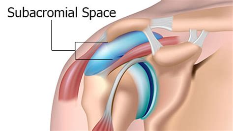 The Painful Arc Test Subacromial Impingement Pilates Therapy Blog