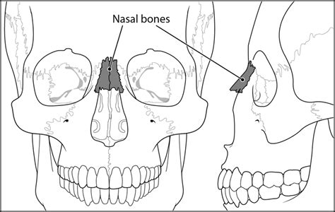 Basic Facial Anatomy Demonstrating Location Of Nasal Bones Download