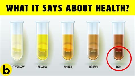 What The Color Of Your Urine Says About Your Health Youtube