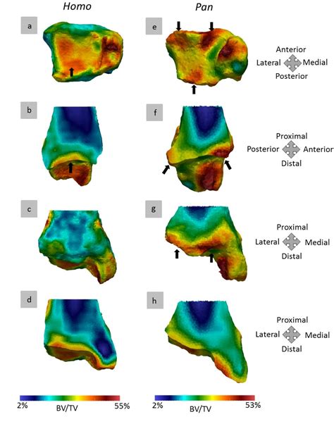 Figure 8 From Trabecular And Cortical Bone Structure Of The Talus And