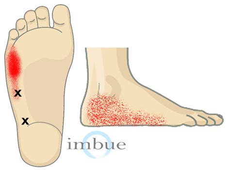 Sharp Pain In Feet And Toes