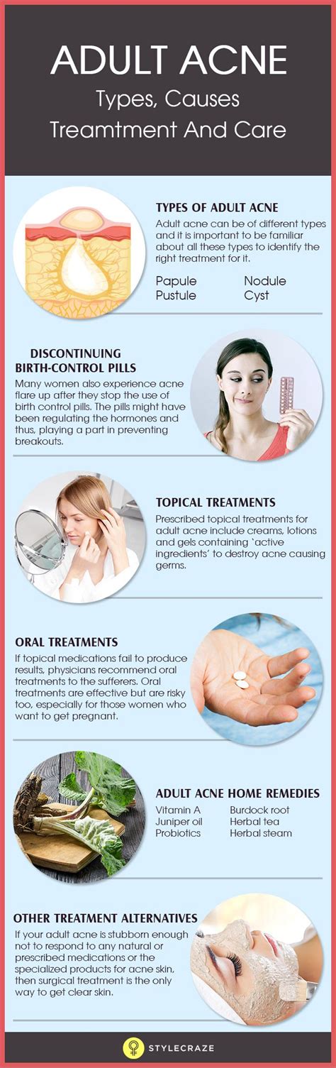 Comedonal Acne Causes How To Treat It And Ways To Prevent It Dry