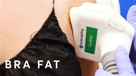 How To Get Rid Of The Bra Fat Youtube