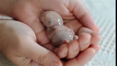 Picture Of Unborn Baby At 12 Weeks Baby Viewer