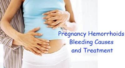 What You Should Know About Hemorrhoids And RLS During Pregnancy