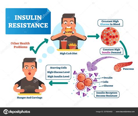 Ilustración De Vectores De Resistencia A La Insulina Esquema