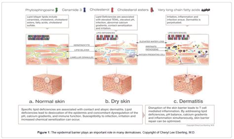 Great Dermatits Study Techniques That Optimize Skin Barrier Repair