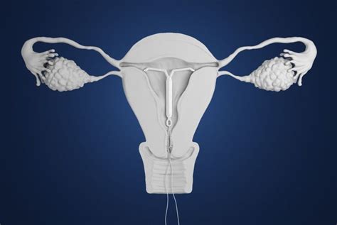 What Women Need To Know About Iuds Health Detox Vitamins
