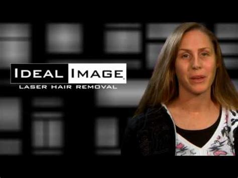 We employ registered nurses, nurse practitioners and physician assistants who are extensively trained in the most effective. Laser Hair Removal - Video Testimonials - Ideal Image ...