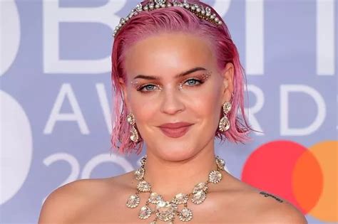 Anne Marie Speaks Out Over Anxiety Battle After Being Stopped From Thinking Normally