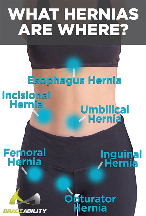 Best Abdominal Hernia Treatment Support Belt For Women