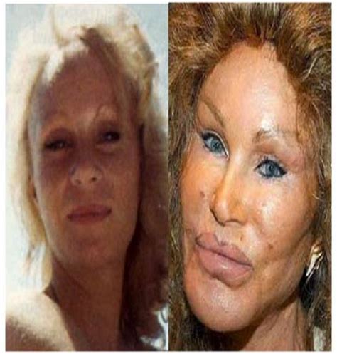 Jocelyn Wildenstein Before And After Bad Celebrity Plastic Surgery