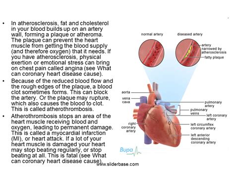 Ischemic heart disease, rheumatic fever, marfan's syndrome, ehlers danlos syndrome, the dilatation of the left ventricle that causes stretching of the mitral valve annulus and displacement of the papillary muscles (dilated cardiomyopathy, etc.) Coronary heart disease - Presentation Health and Disease