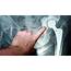 Hip Joint Replacement – Characteristics Causes Treatment