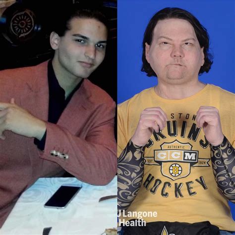 A 22-year-old who lost his lips, eyelids, and fingers in a burning car