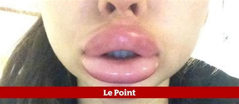 Les Selfies Aux Lèvres Gonflées Nouveau Défi Des Ados Le Point