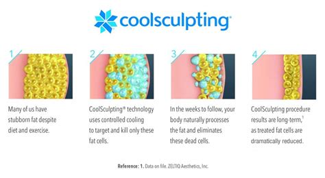 Coolsculpting Fat Freezing Embody Medspa
