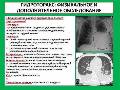 Диета при инфильтративном туберкулезе легких Диета При Гидротораксе Легких — Похудение Диета Правильное Питание Диета При Гидротораксе Легких — Похудение Диета Правильное Питание Диета при инфильтративном туберкулезе легких