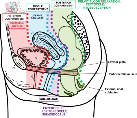 Labeled Pelvic Spaces Uterine Google Search Anatomy Models Labeled My