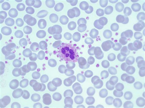 Platelets A Laboratory Guide To Clinical Hematology