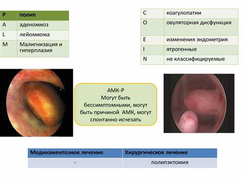 Диета маточное кровотечение Аномальные маточные кровотечения - презентация онлайн Аномальные маточные кровотечения - презентация онлайн Диета маточное кровотечение