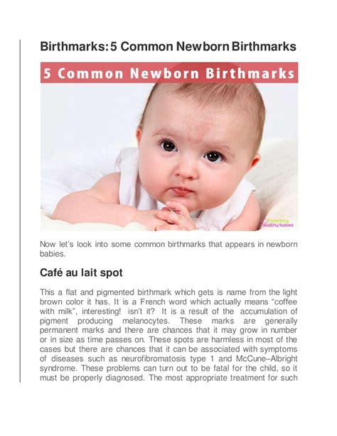 5 Common Newborn Birthmarks You Need To Know