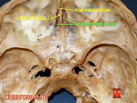 Ethmoid bone cranial bones the seven bones which articulate to form the orbit. Ethmoid Bone; Cribriform Plate