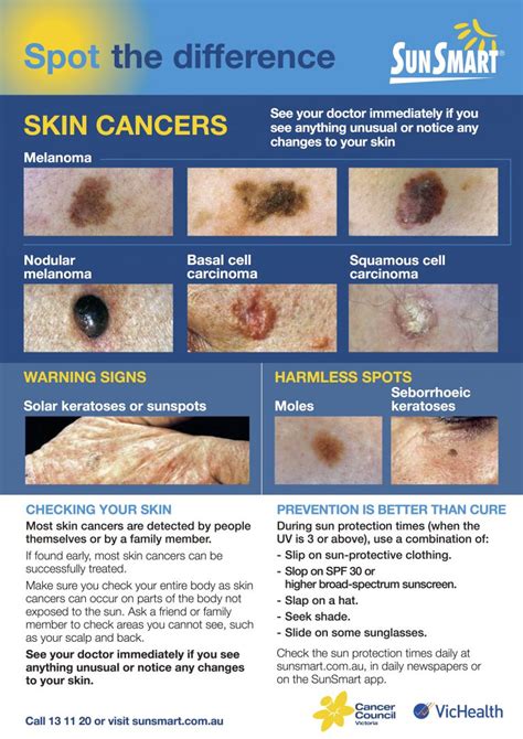 Skin Checks Mole Removal Cranbourne Croydon HealthMint