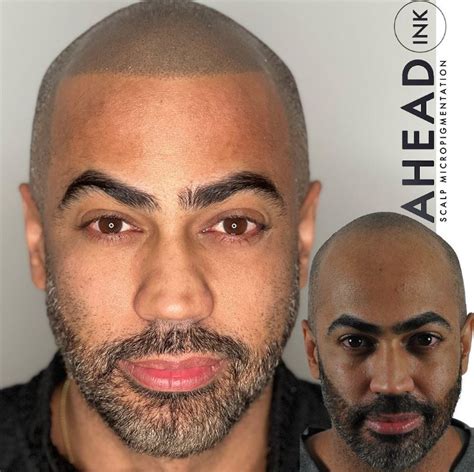 Ahead Ink Best Scalp Micropigmentation New Jersey