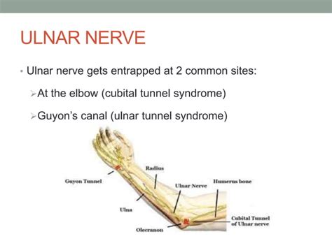 Entrapment Neuropathy Of The Upper Limb Ppt