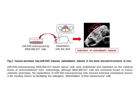 Forming And Resorbing Bones Metastasizing Cancer Cells Modify Bone