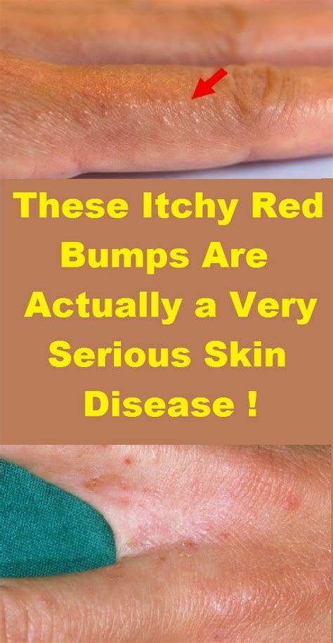 Causes Of Itchy Skin