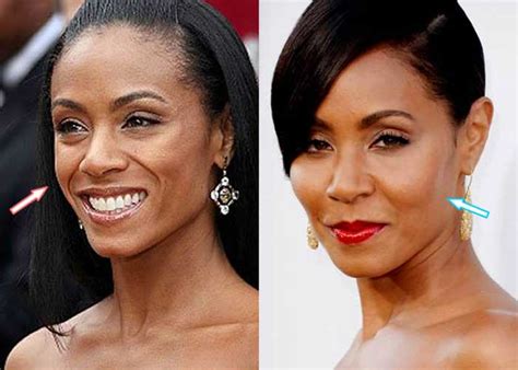 Jada Pinkett Smith Plastic Surgery Facelift Botox Nose Job