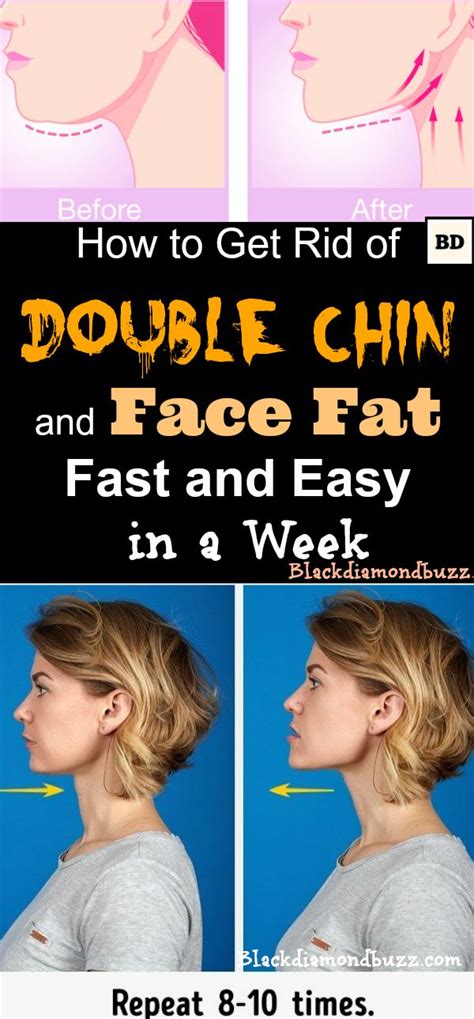 Asking for a friend, why is face fat so hard to get rid of? How to Get Rid of Double Chin and Face Fat Fast and Easy in a Week.Included here double chin ...
