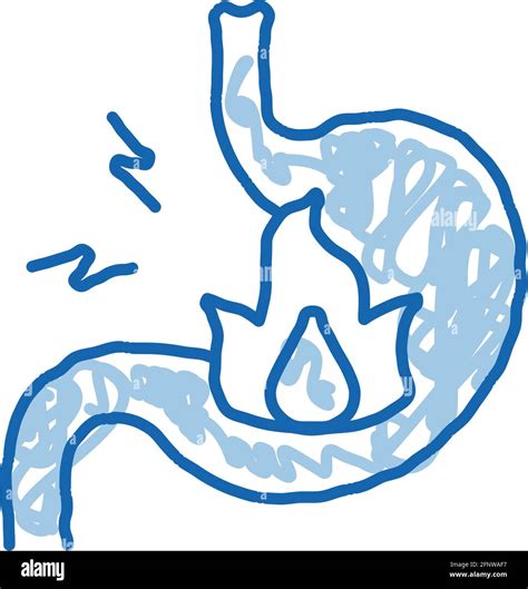 Severe Heartburn Stomach Pain Doodle Icon Hand Drawn Illustration Stock
