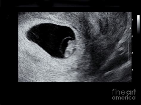 Embryo At Seven Weeks Photograph By Dr Najeeb Layyous Science Photo