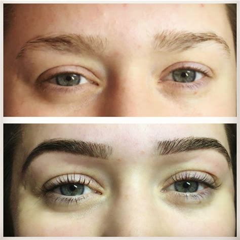 8 Stunning Examples Of Before And After Eyebrow Treatment The Eyebrow Specialist Sunnybank Hills
