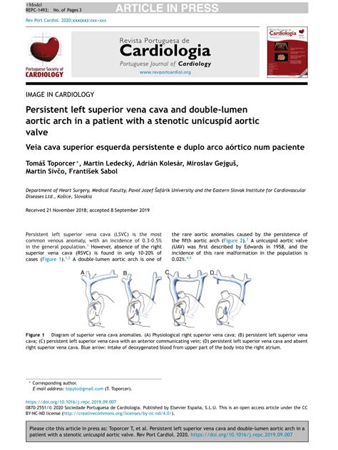 Pdf Persistent Left Superior Vena Cava And Double Lumen Aortic Arch