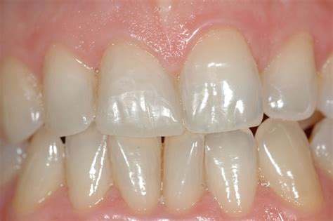 Odontoiatria Conservativa Studio Dentistico Pompilio
