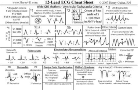 Image Result For Lead Ecg Placement Mnemonic Nursing Babe Studying Nursing Babe Notes