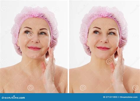 Closeup Before After Beauty Middle Age Woman Face Portrait Before