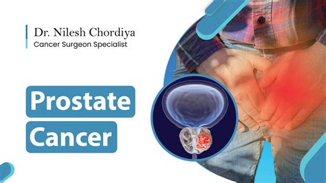 Stages And Treatments Of Prostate Cancer Dr Nilesh Chordiya
