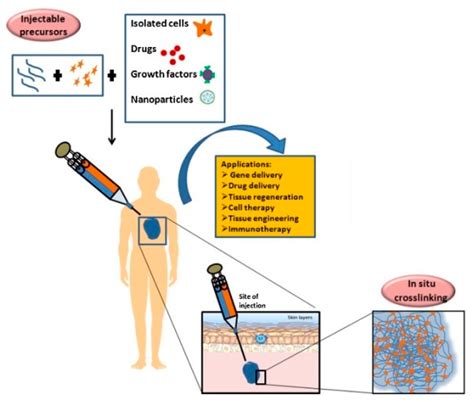 Pharmaceutics Free Full Text Injectable Hydrogels For Cancer