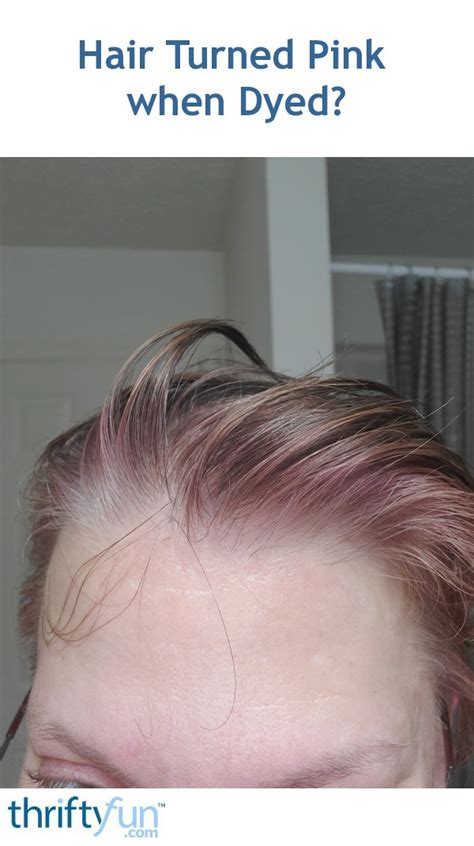 Hair Turned Pink When Dyed Thriftyfun