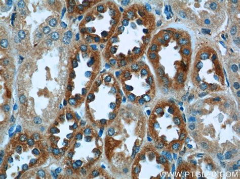 P3h2 Antibody 15723 1 Ap Proteintech 武汉三鹰生物技术有限公司