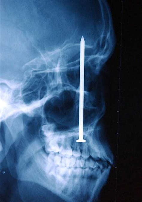 Unbelievably Bizarre X Rays Klykercom