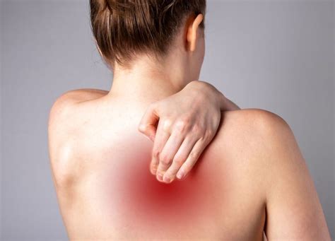 Pinched Nerve In Shoulder Blade Causes Symptoms Treatments And