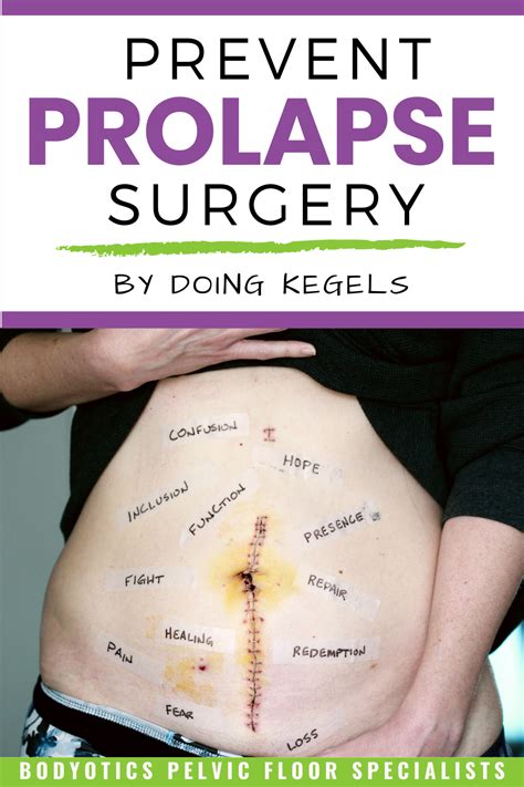 How To Fix A Prolapsed Bladder Without Surgery